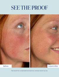 Redness Corrector