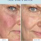 Redness Corrector