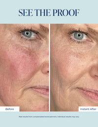 Redness Corrector