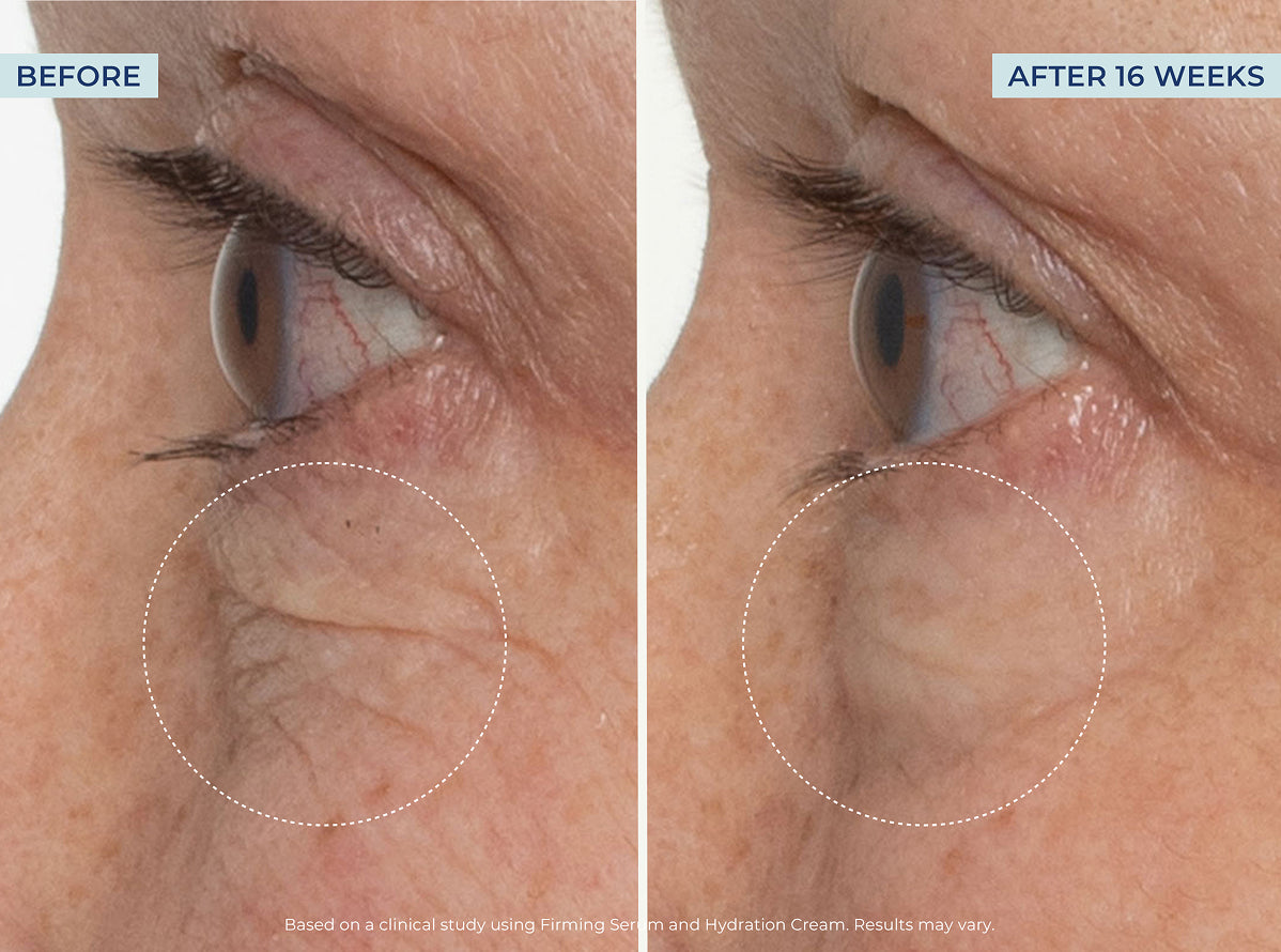 Deluxe Kit – Image 9 of 14